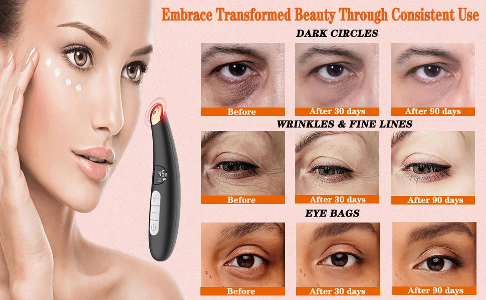 3-in-1 Electric Eye Massager Wand - LED Light Therapy Face Lift Beauty Device for Dark Circles, Puffiness & Fine Lines